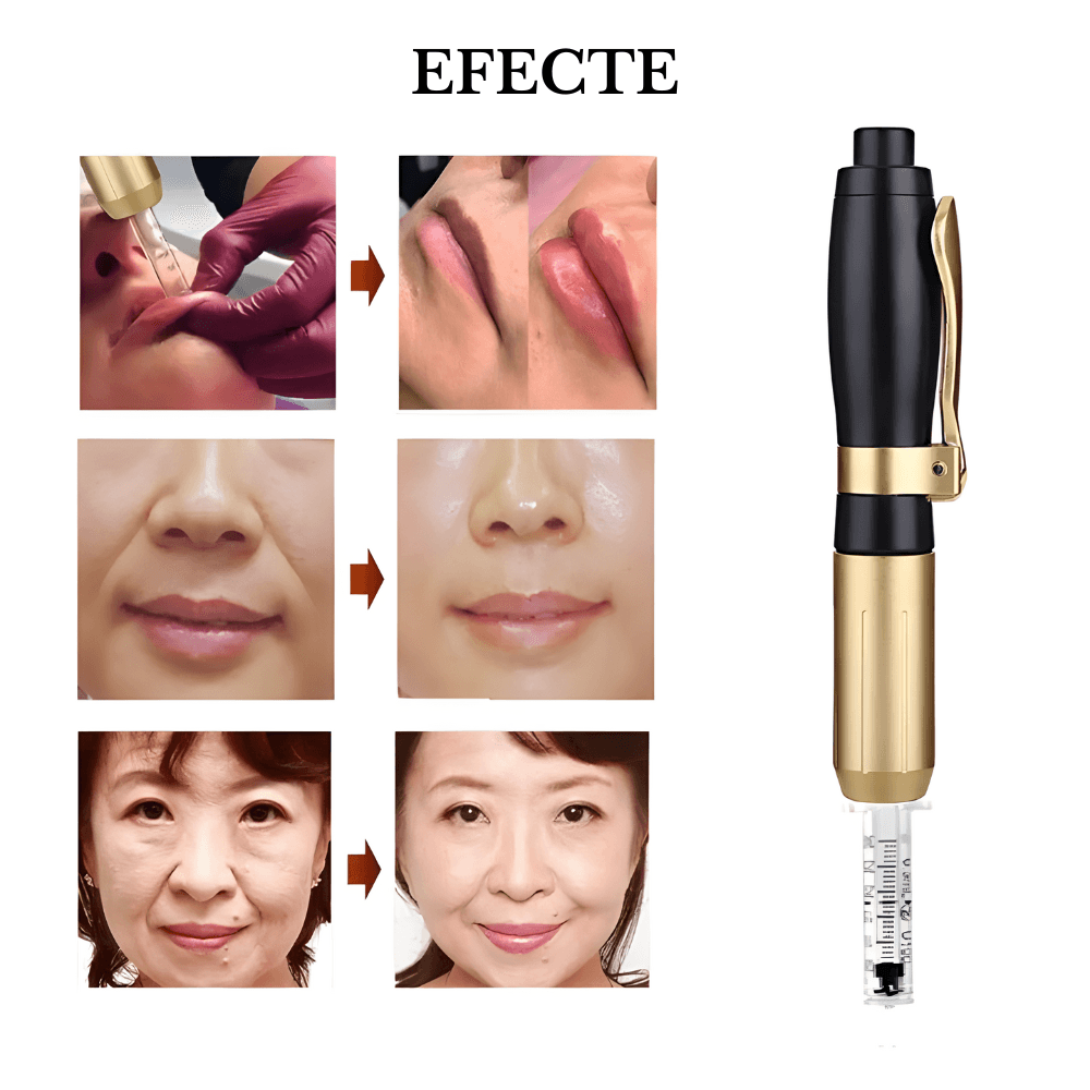 Dispozitiv Premium Reglabil, pentru Aplicarea Acidului Hialuronic fara Ac, Hyaluron Pen, Metalic, Marirea Buzelor - imagine 4